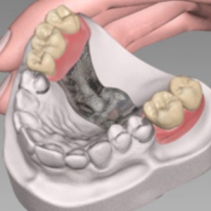 Матеріали для зубних протезів