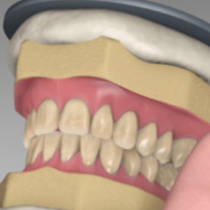 Зубні протези